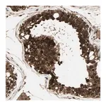 Merck Anti-CSNK2B antibody produced in rabbit