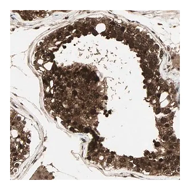 Merck Anti-CSNK2B antibody produced in rabbit
