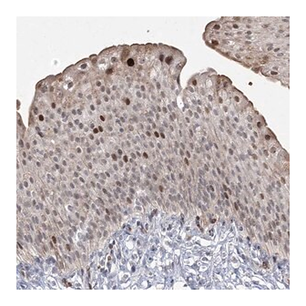 Merck Anti-NSMCE4A antibody produced in rabbit