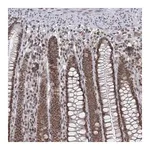 Merck Anti-TREX1 antibody produced in rabbit