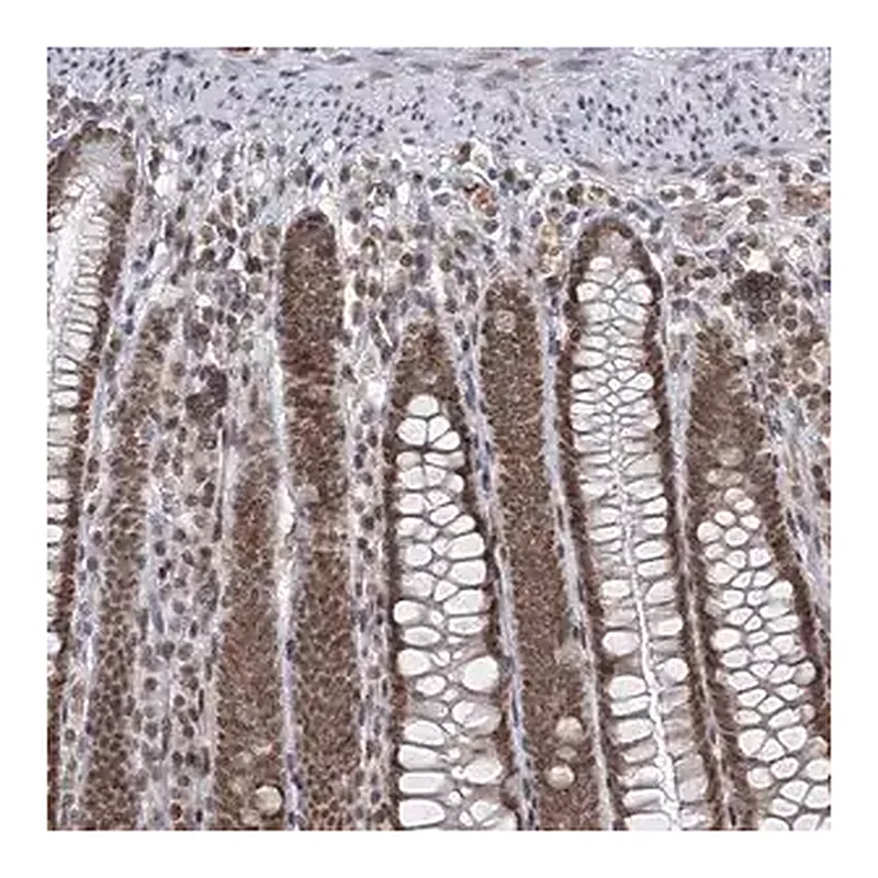 Merck Anti-TREX1 antibody produced in rabbit