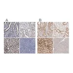 Merck Anti-ACOX1 antibody produced in rabbit