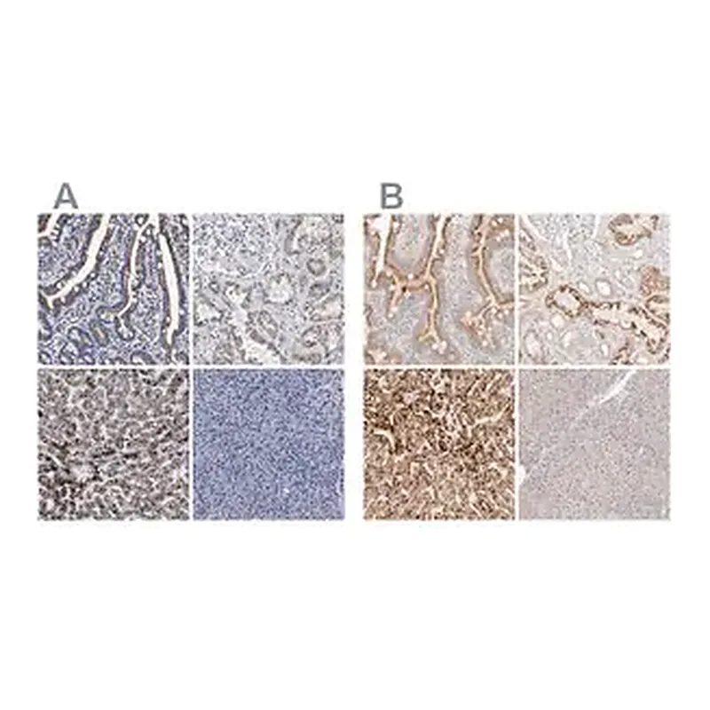 Merck Anti-ACOX1 antibody produced in rabbit
