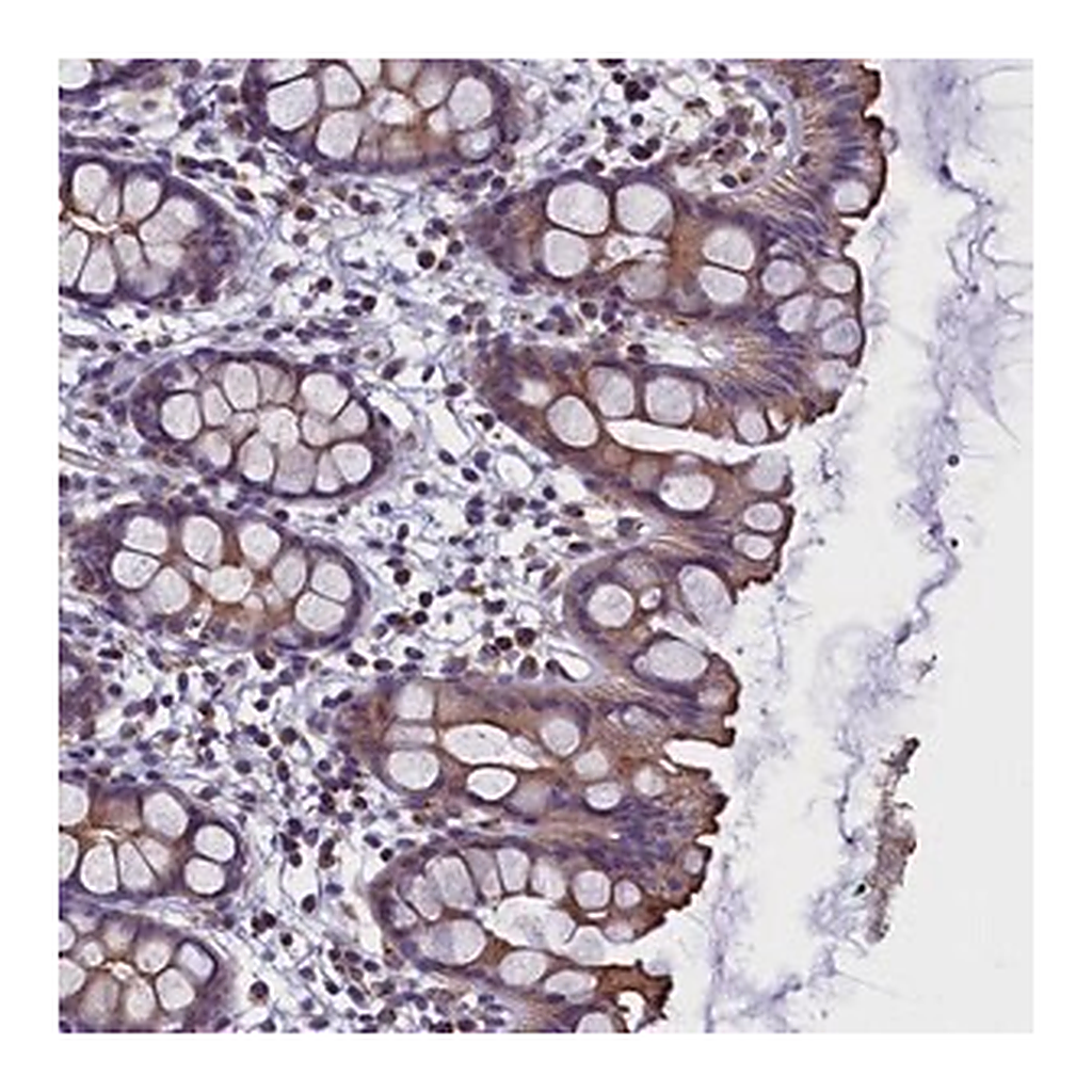 Merck Anti-STK32A antibody produced in rabbit