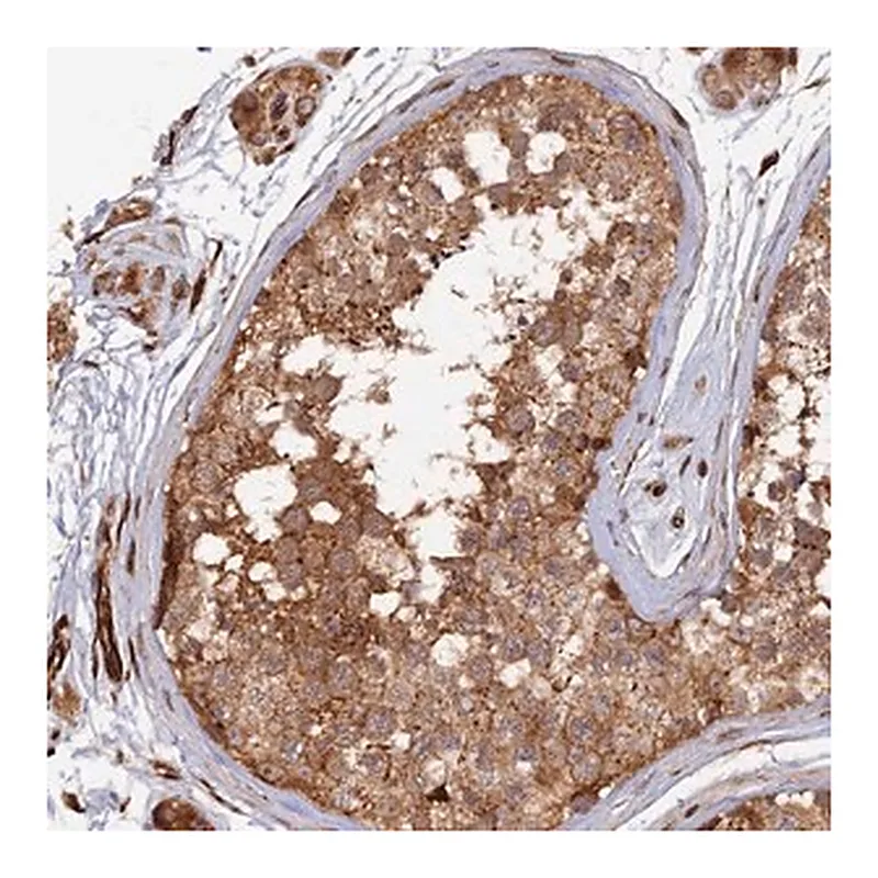 Merck Anti-PPP2R3C antibody produced in rabbit