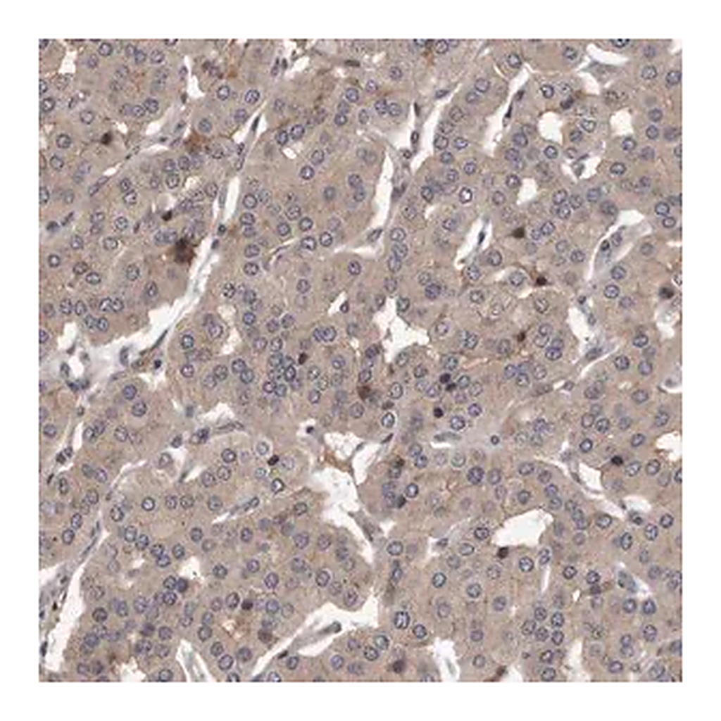 Merck Anti-PRKD1 antibody produced in rabbit