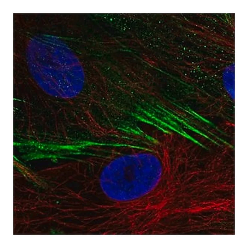 Merck Anti-SCN9A antibody produced in rabbit