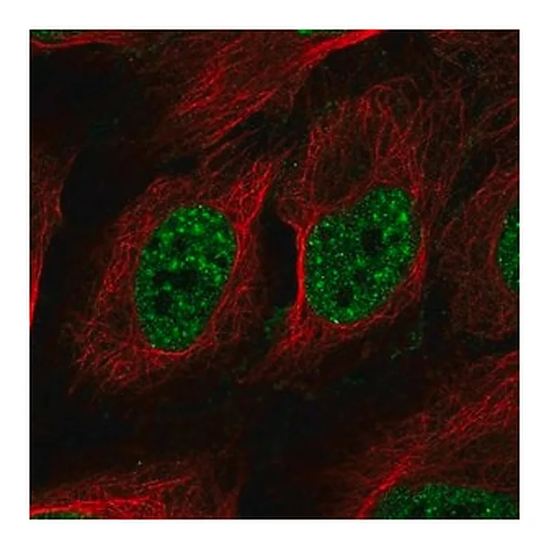 Merck Anti-RAD52 antibody produced in rabbit