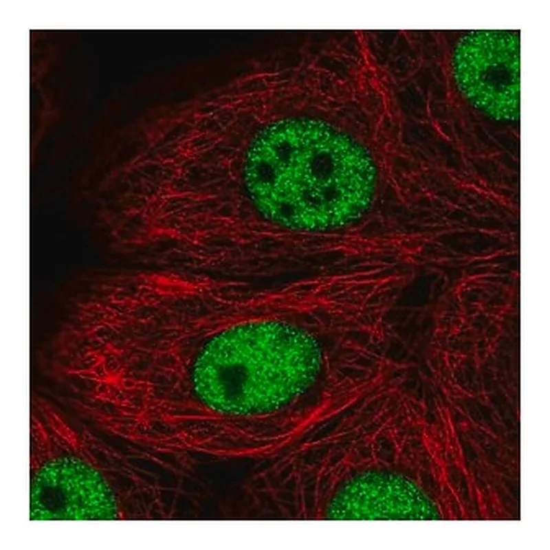 Merck Anti-TBX2 antibody produced in rabbit