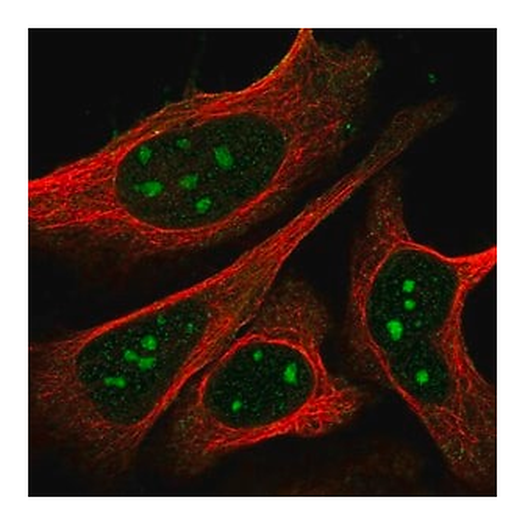 Merck Anti-NPR1 antibody produced in rabbit