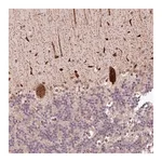 Merck Anti-ALKBH8 antibody produced in rabbit