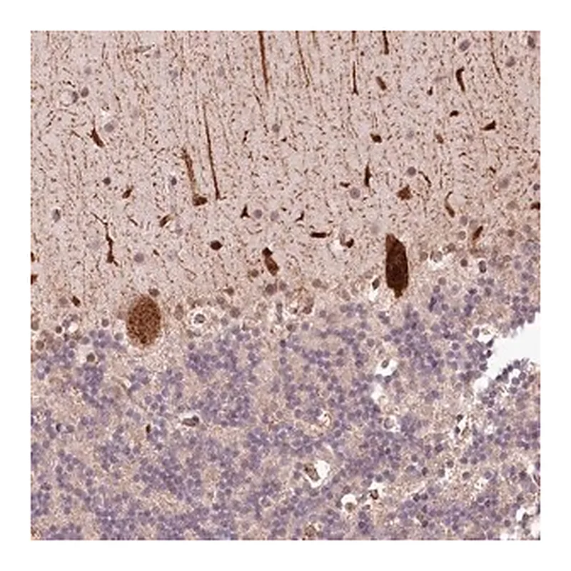 Merck Anti-ALKBH8 antibody produced in rabbit