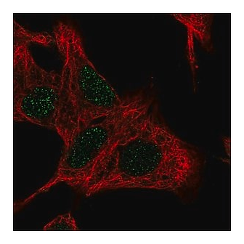 Merck Anti-UCK2 antibody produced in rabbit