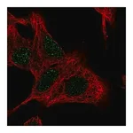 Merck Anti-UCK2 antibody produced in rabbit