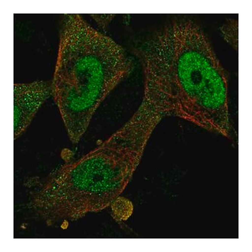 Merck Anti-FBXO32 antibody produced in rabbit