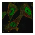 Merck Anti-FBXO32 antibody produced in rabbit