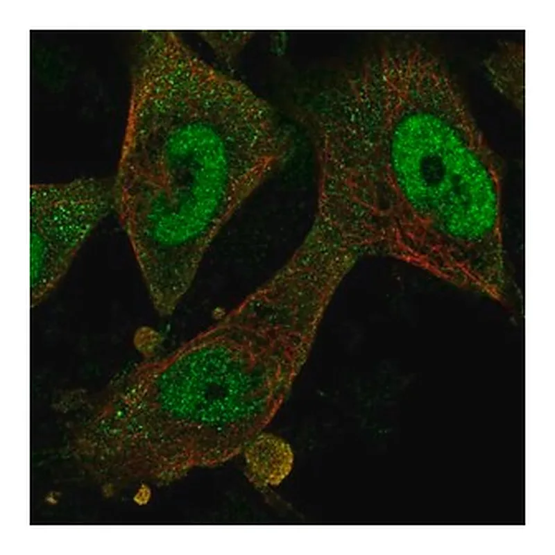 Merck Anti-FBXO32 antibody produced in rabbit