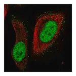 Merck Anti-PMS2 antibody produced in rabbit