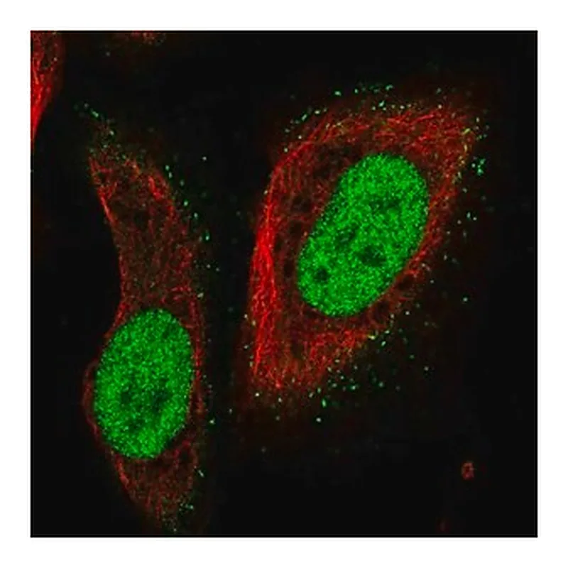 Merck Anti-PMS2 antibody produced in rabbit