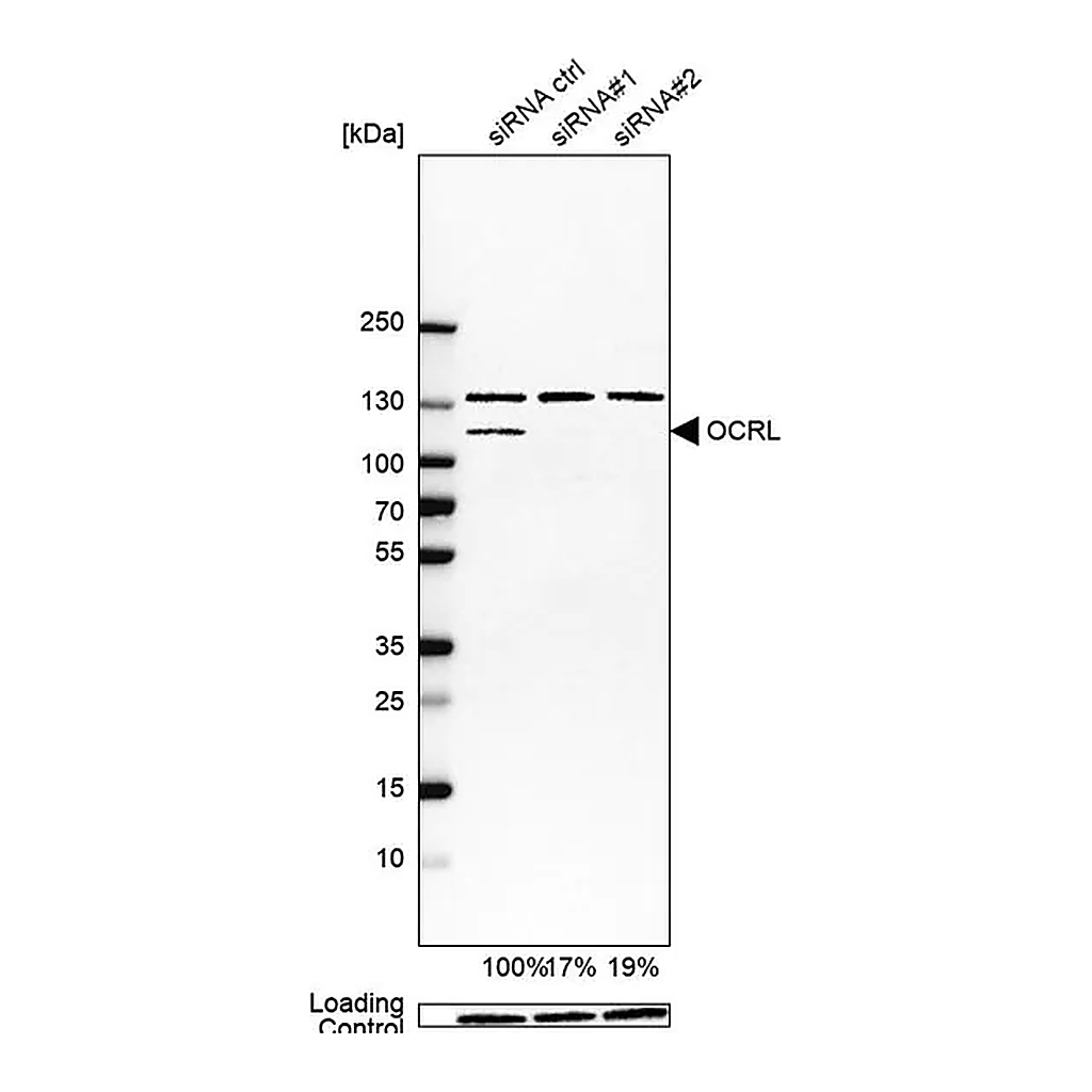Merck Anti-OCRL antibody produced in rabbit