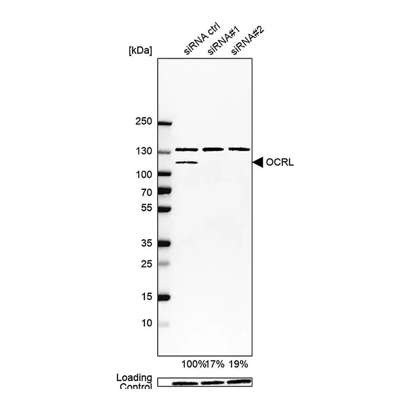 Merck Anti-OCRL antibody produced in rabbit