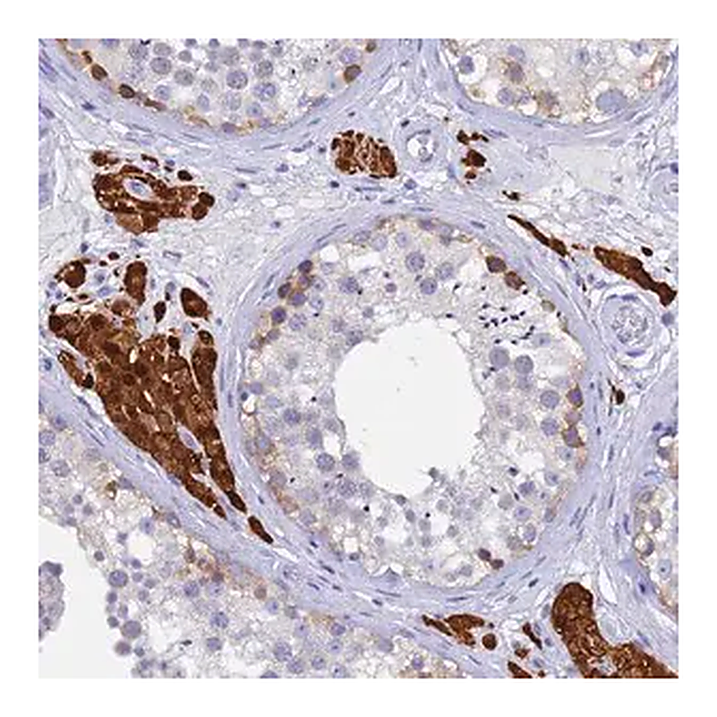 Merck Anti-UBE2O antibody produced in rabbit