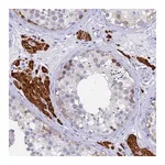Merck Anti-UBE2O antibody produced in rabbit