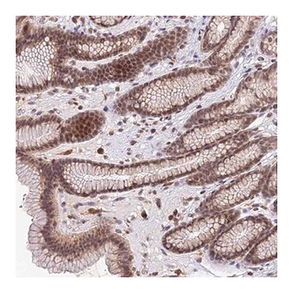 Merck Anti-TPRX1 antibody produced in rabbit