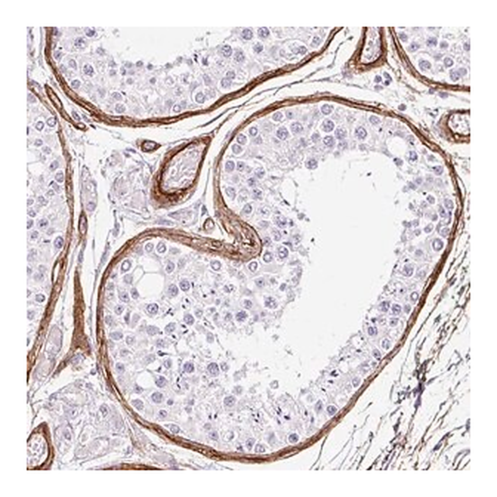 Merck Anti-LOXL4 antibody produced in rabbit