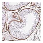 Merck Anti-LOXL4 antibody produced in rabbit