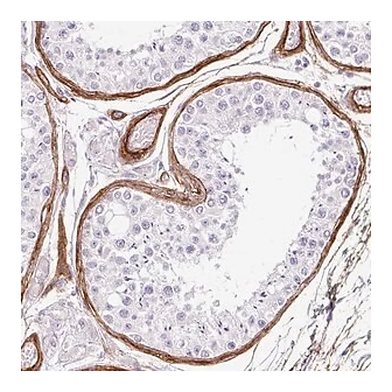 Merck Anti-LOXL4 antibody produced in rabbit