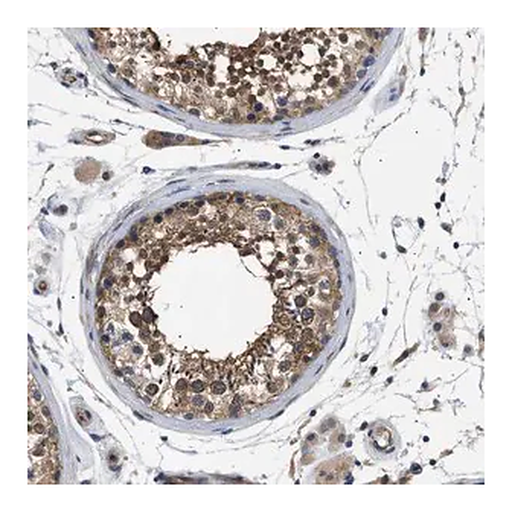 Merck Anti-CRCP antibody produced in rabbit