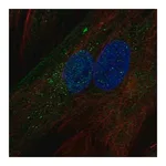 Merck Anti-IGFBP5 antibody produced in rabbit