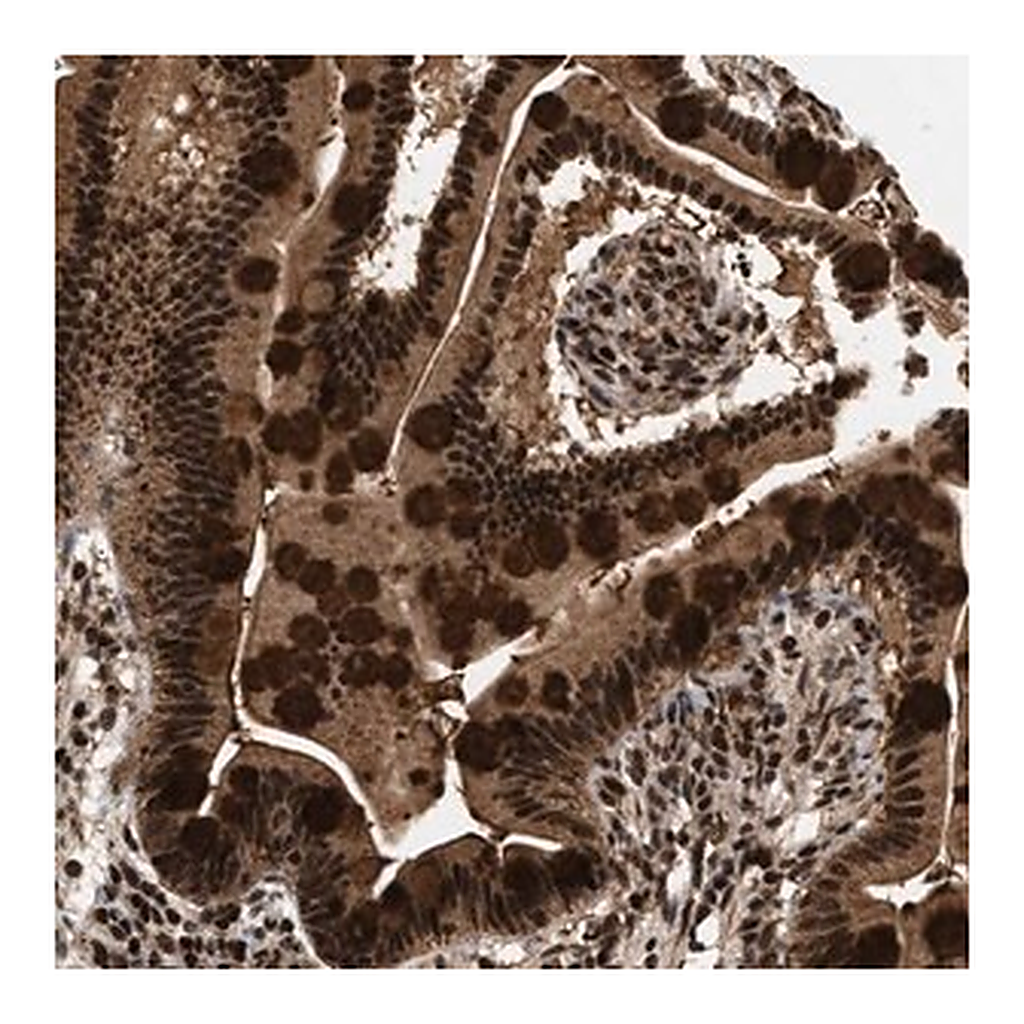 Merck Anti-RBM5 antibody produced in rabbit
