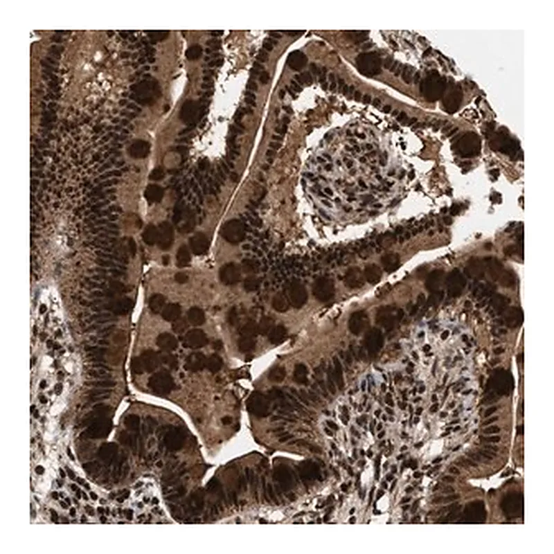 Merck Anti-RBM5 antibody produced in rabbit