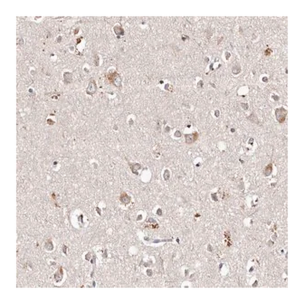 Merck Anti-TSC2 antibody produced in rabbit
