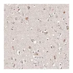 Merck Anti-TSC2 antibody produced in rabbit