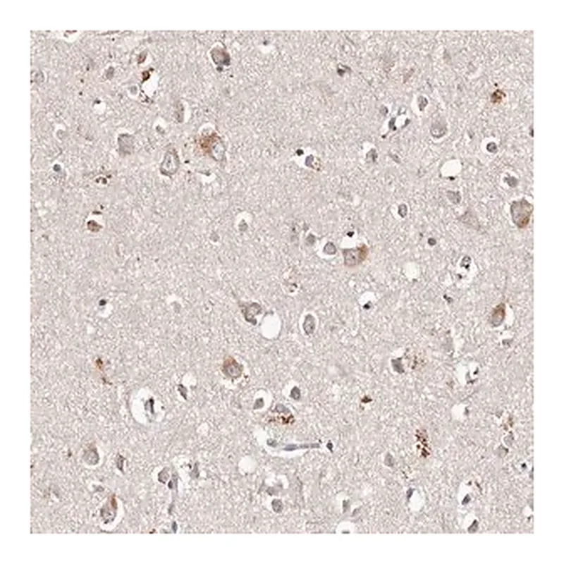 Merck Anti-TSC2 antibody produced in rabbit
