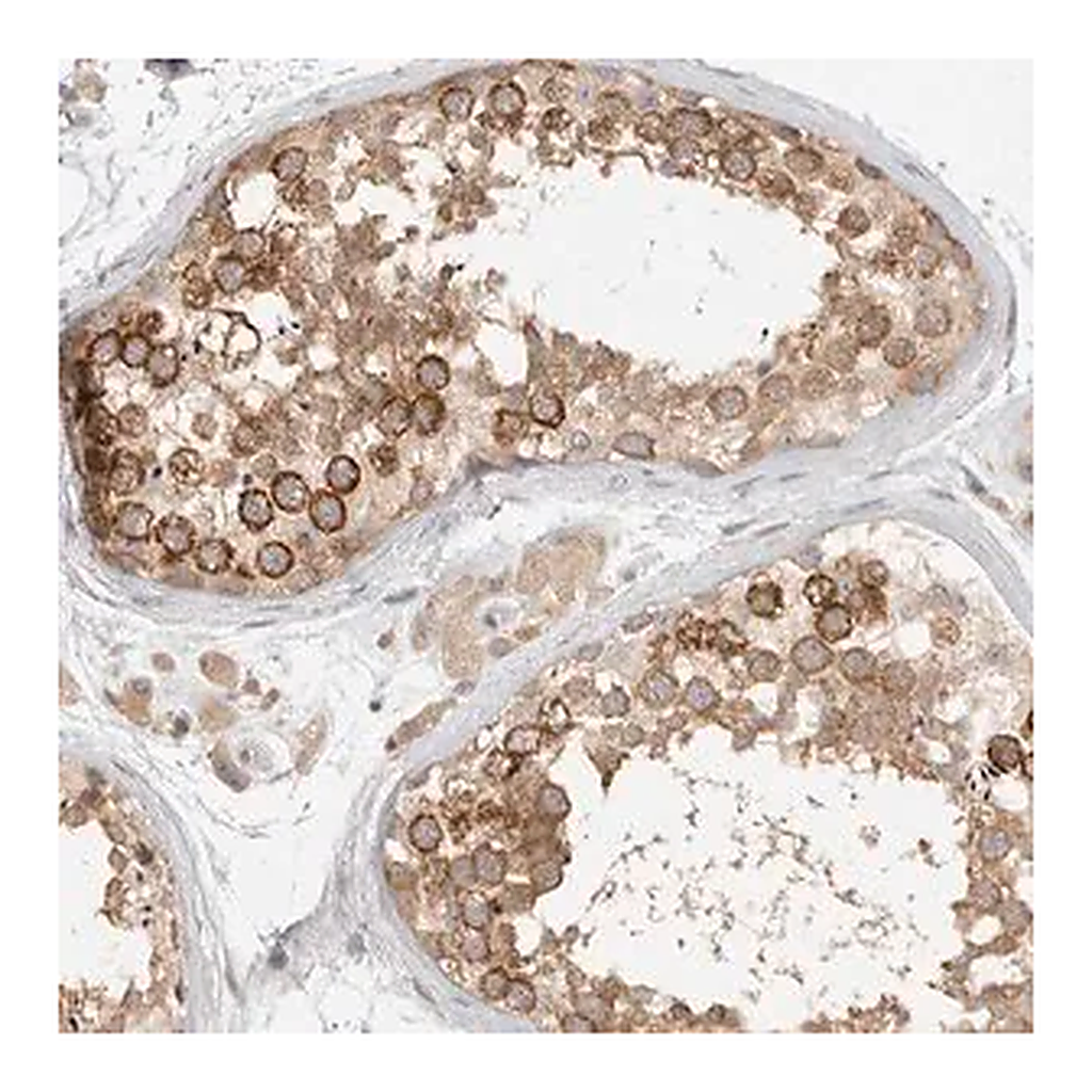 Merck Anti-HDAC6 antibody produced in rabbit