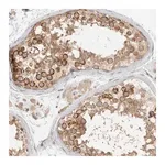 Merck Anti-HDAC6 antibody produced in rabbit
