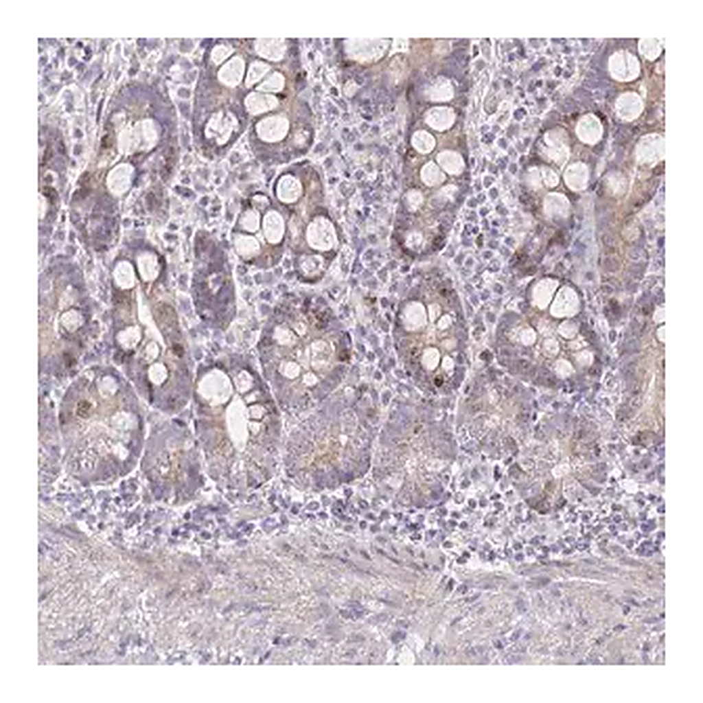 Merck Anti-CENPH antibody produced in rabbit