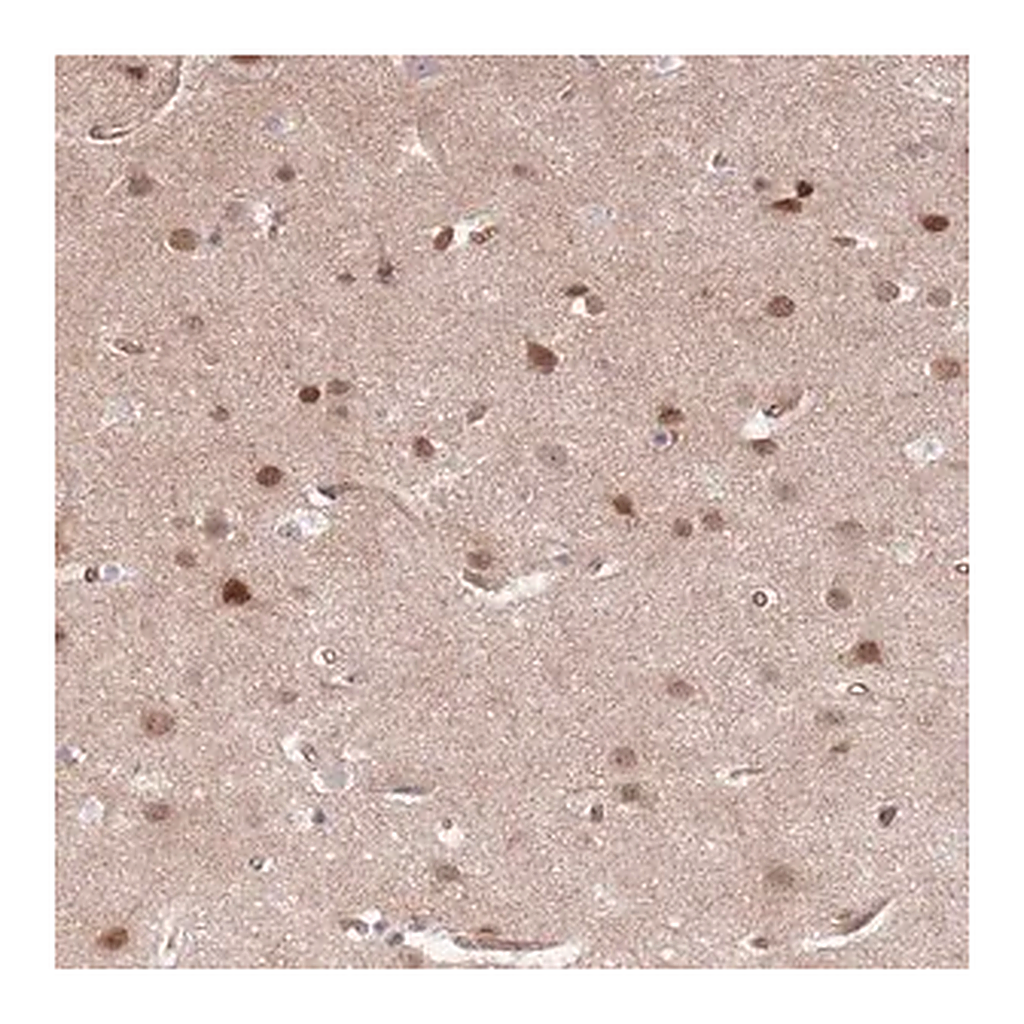 Merck Anti-TCF20 antibody produced in rabbit