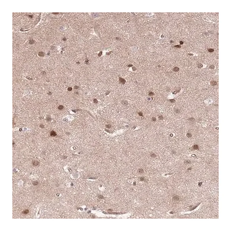 Merck Anti-TCF20 antibody produced in rabbit