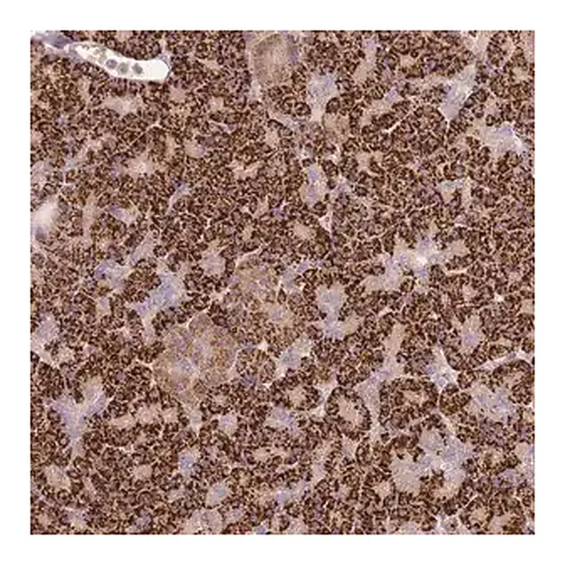 Merck Anti-PVRIG antibody produced in rabbit