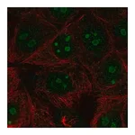 Merck Anti-RPL22L1 antibody produced in rabbit