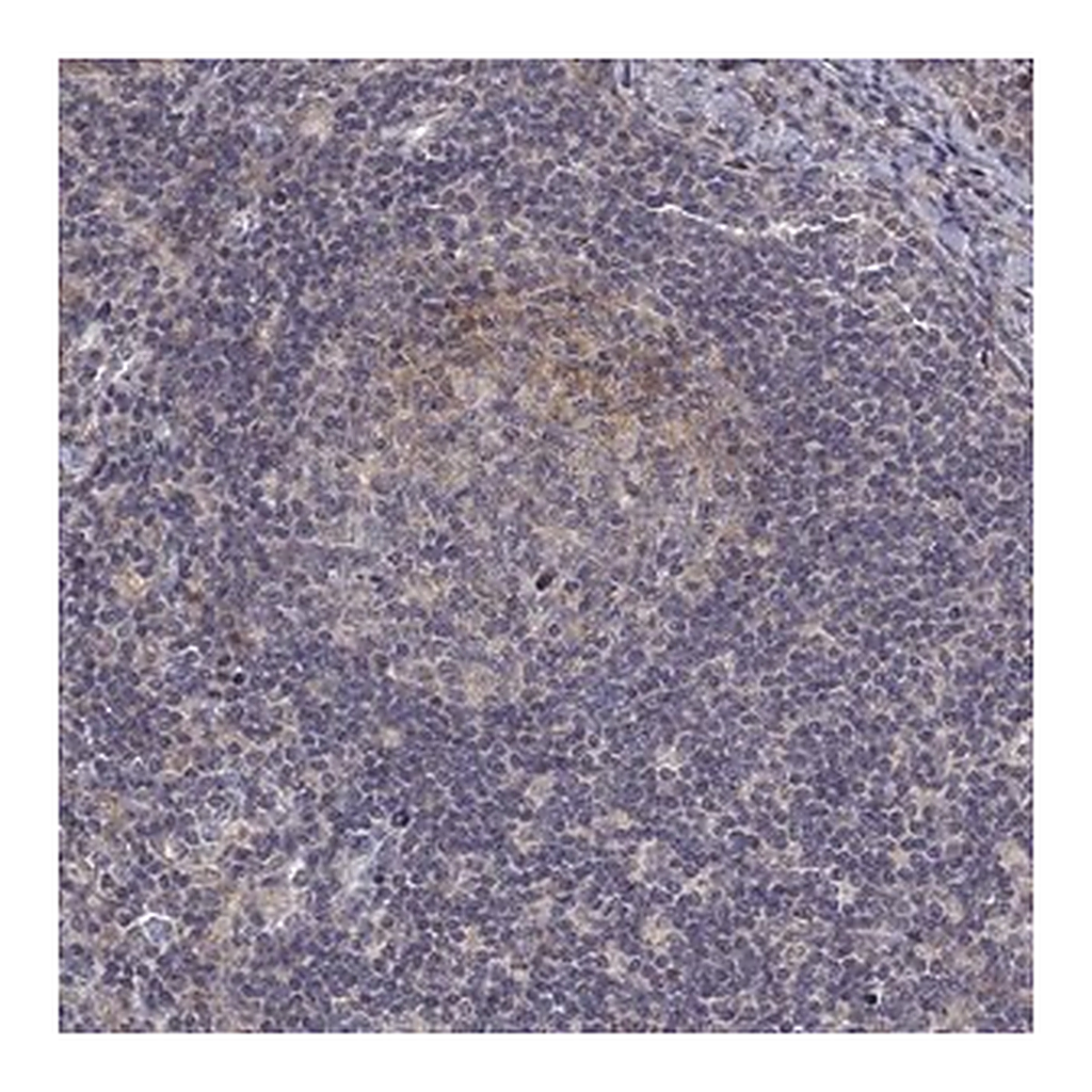 Merck Anti-ALKBH8 antibody produced in rabbit