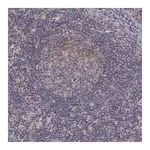 Merck Anti-ALKBH8 antibody produced in rabbit