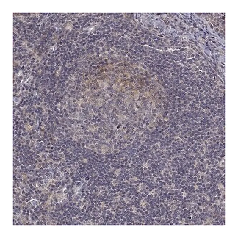Merck Anti-ALKBH8 antibody produced in rabbit