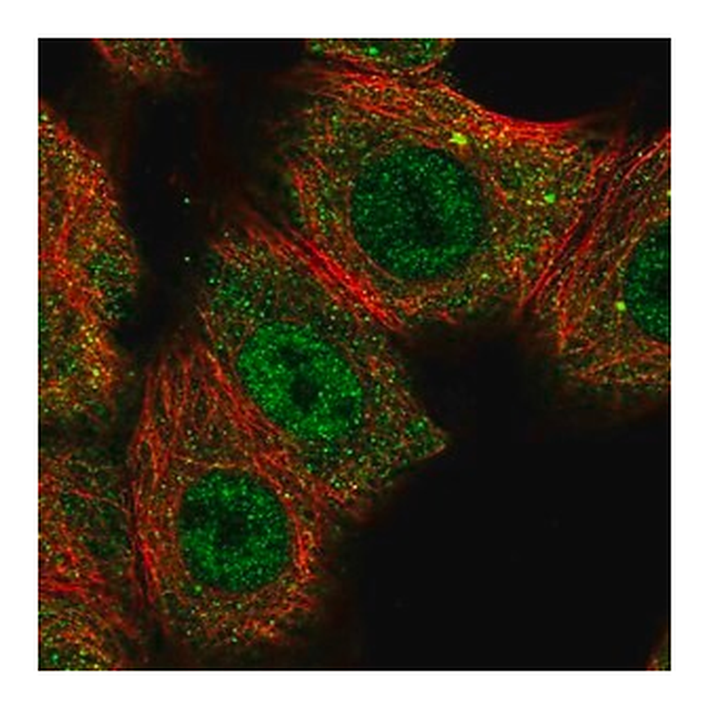 Merck Anti-CNOT10 antibody produced in rabbit