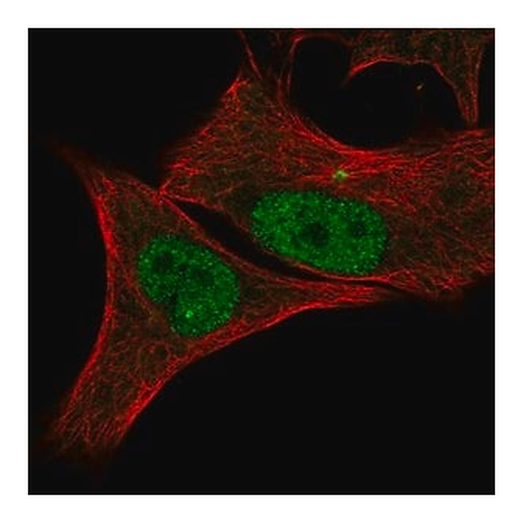 Merck Anti-CDK2 antibody produced in rabbit